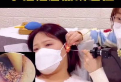 掏耳朵视频,趣味视频带你领略耳道清洁的奥秘